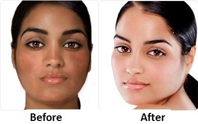 Skin Whitening Pills Skin Lightening