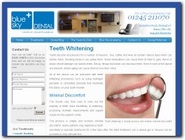 http://www.blueskydental.co.uk/treatments/teeth-whitening-essex website
