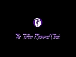 https://www.tattooremovalcoventry.com/ website