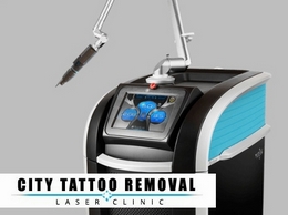 https://citytattooremoval.com/ website