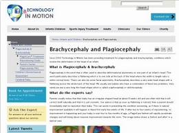 https://www.technologyinmotion.com/head-abnormalities/plagiocephaly website