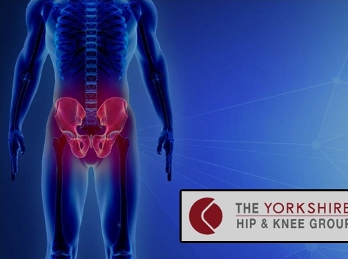 https://www.yorkshirehipandknee.com/ website