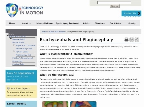 https://www.technologyinmotion.com/head-abnormalities/plagiocephaly website